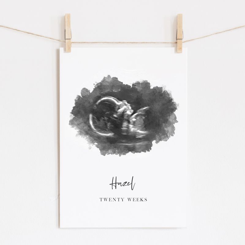 Custom Order for Alyssa Pinter - Ultrasound and Heartbeat Wave Art Print