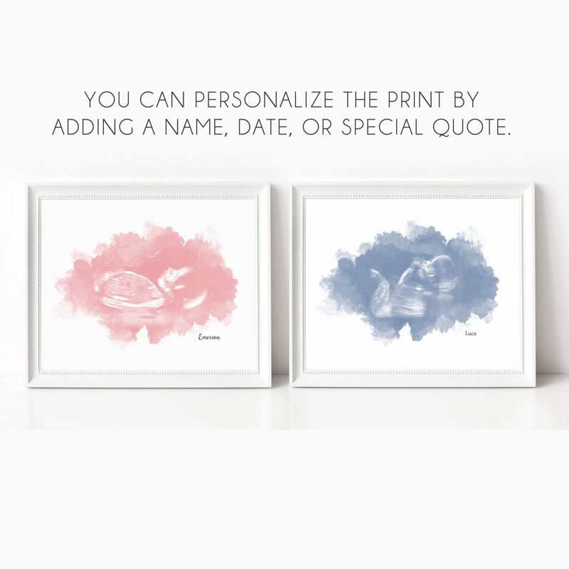Ultrasound Art with Watercolor Gradient