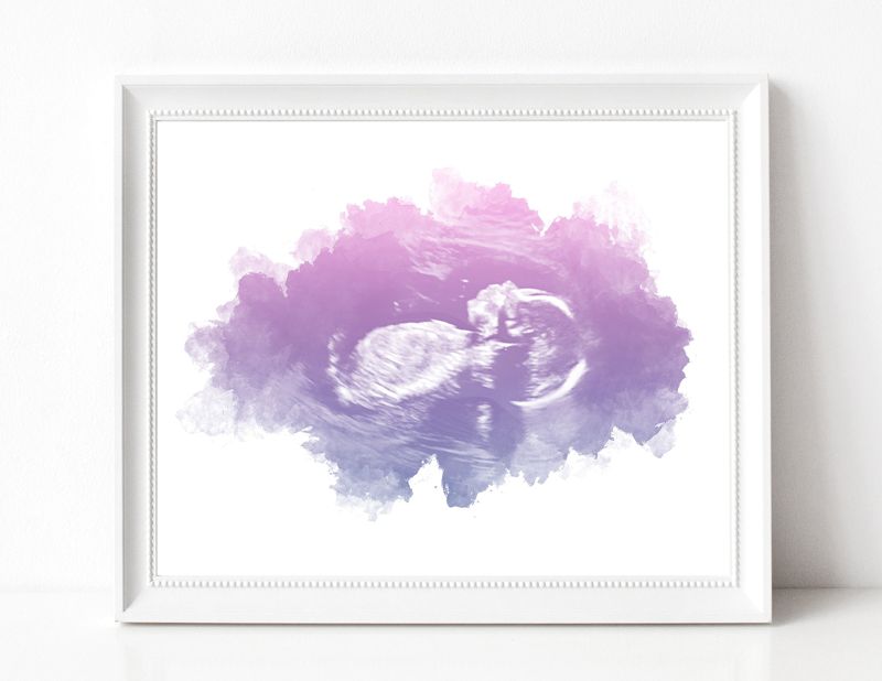 Ultrasound Art with Watercolor Gradient