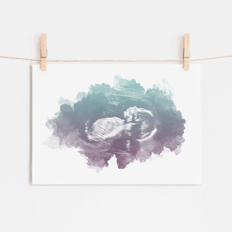 Ultrasound Art with Watercolor Gradient