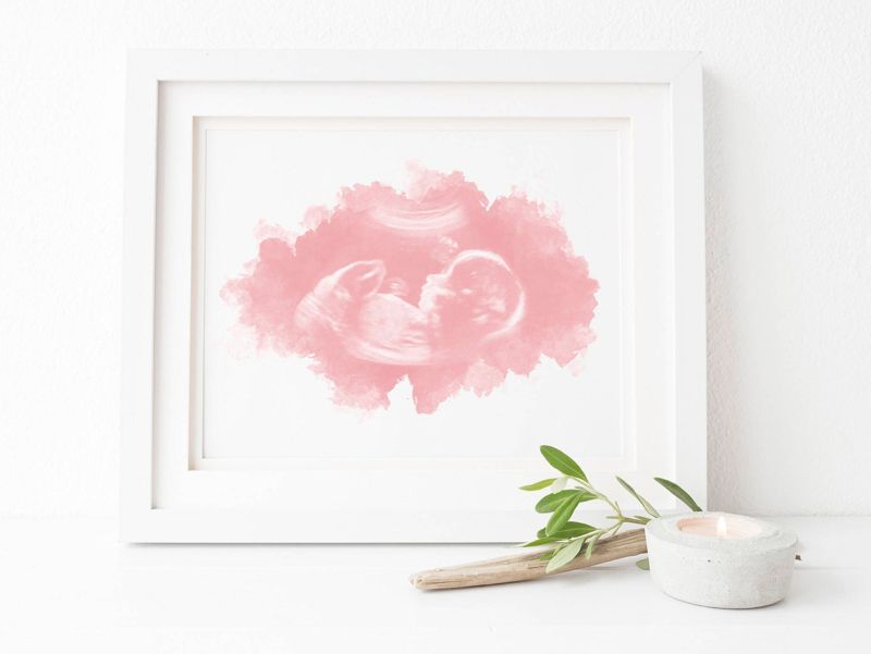 Watercolor Ultrasound Art - Classic