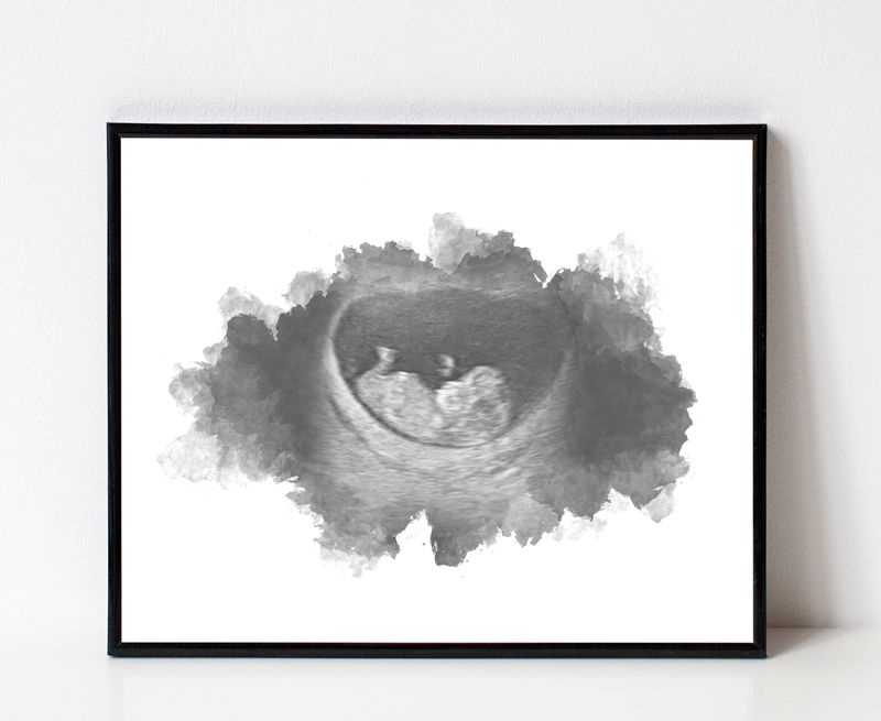 Watercolor Ultrasound Art - Classic
