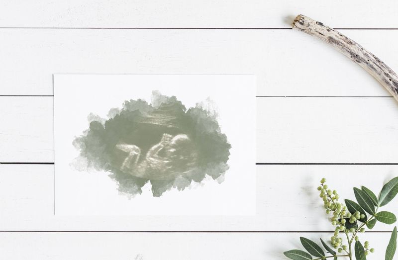 Watercolor Ultrasound Art - Classic