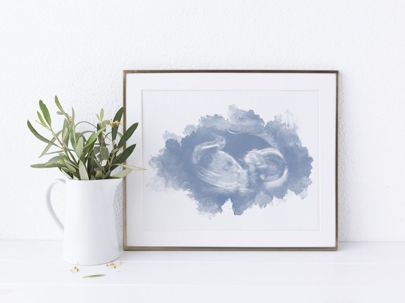 Watercolor Ultrasound Art - Classic