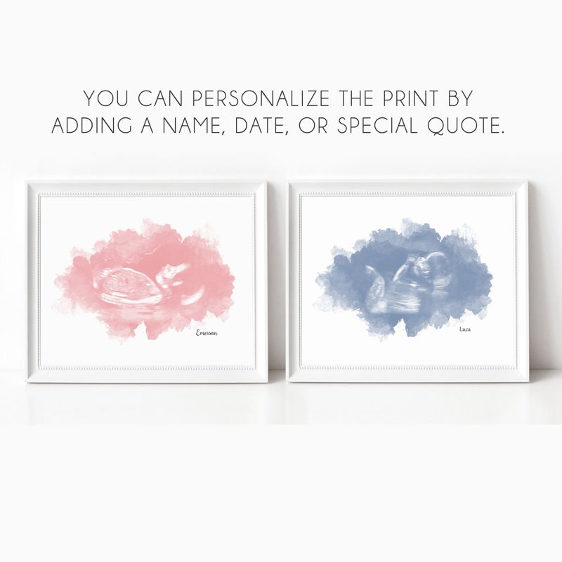 Watercolor Ultrasound Art - Classic