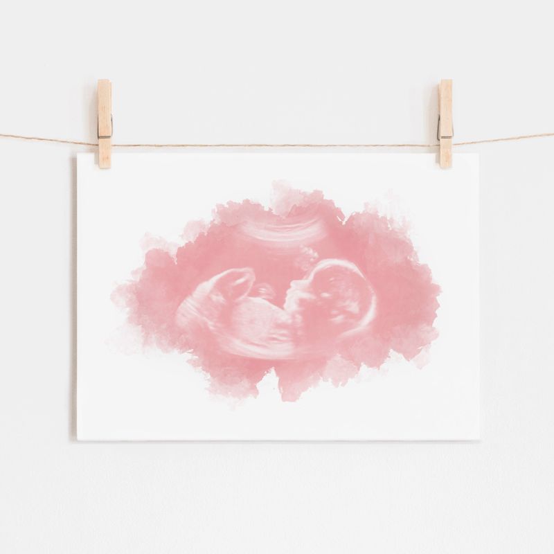 Watercolor Ultrasound Art - Classic