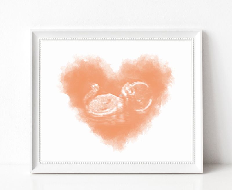 Watercolor Ultrasound Art - Heart
