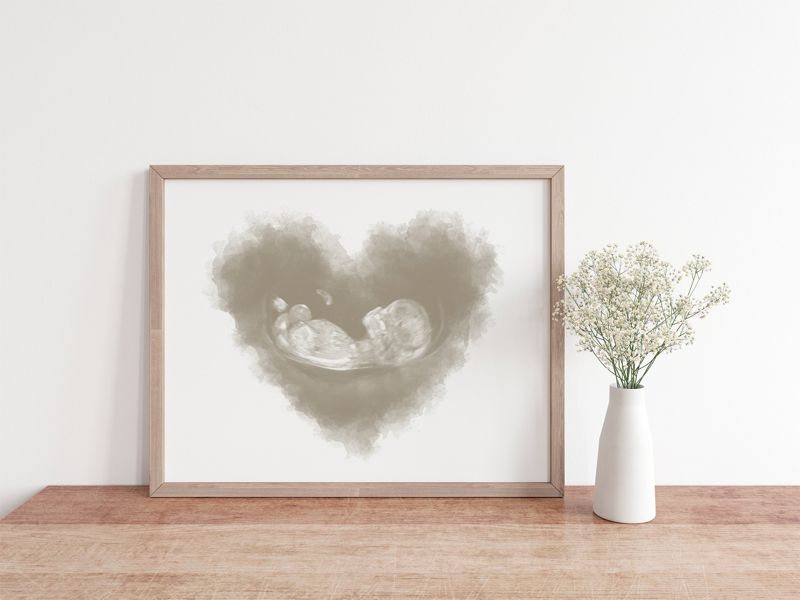 Watercolor Ultrasound Art - Heart
