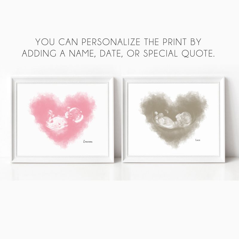 Watercolor Ultrasound Art - Heart