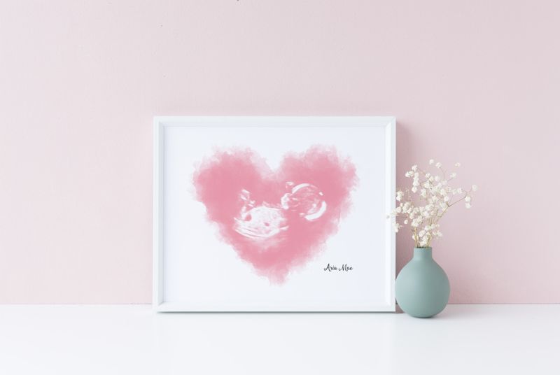 Watercolor Ultrasound Art - Heart