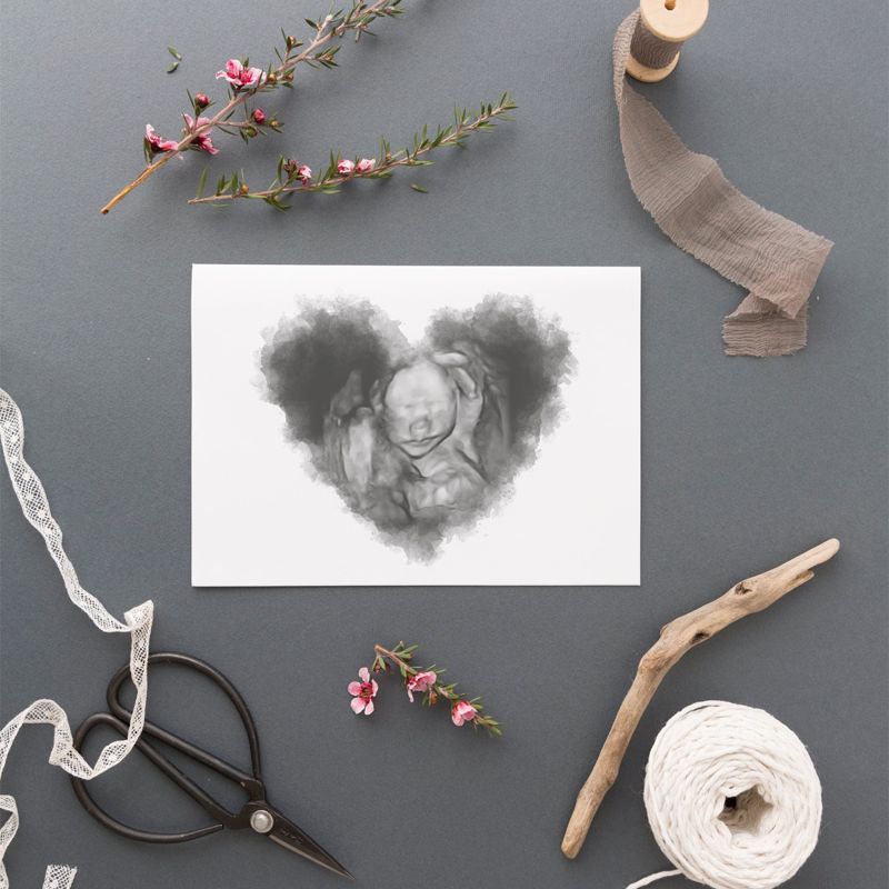 Watercolor Ultrasound Art - Heart
