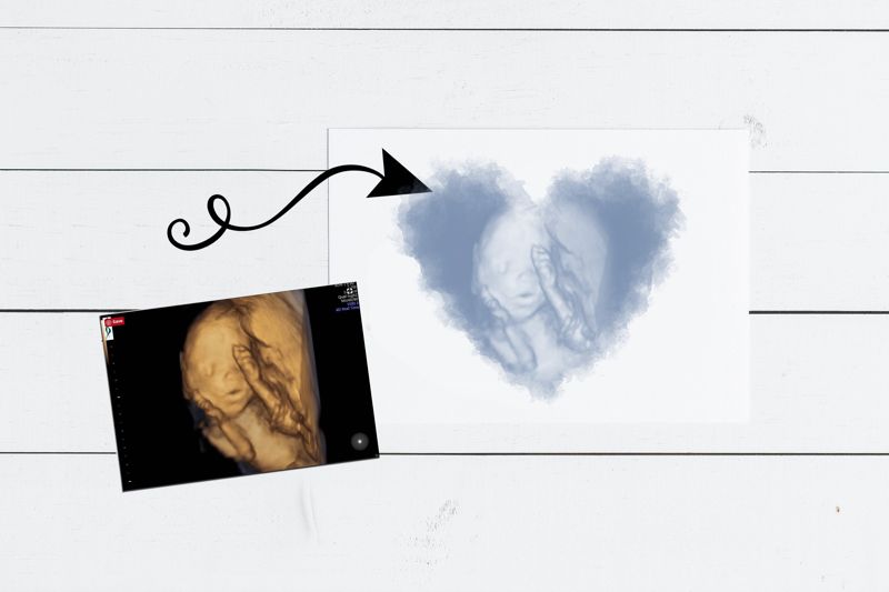 Watercolor Ultrasound Art - Heart