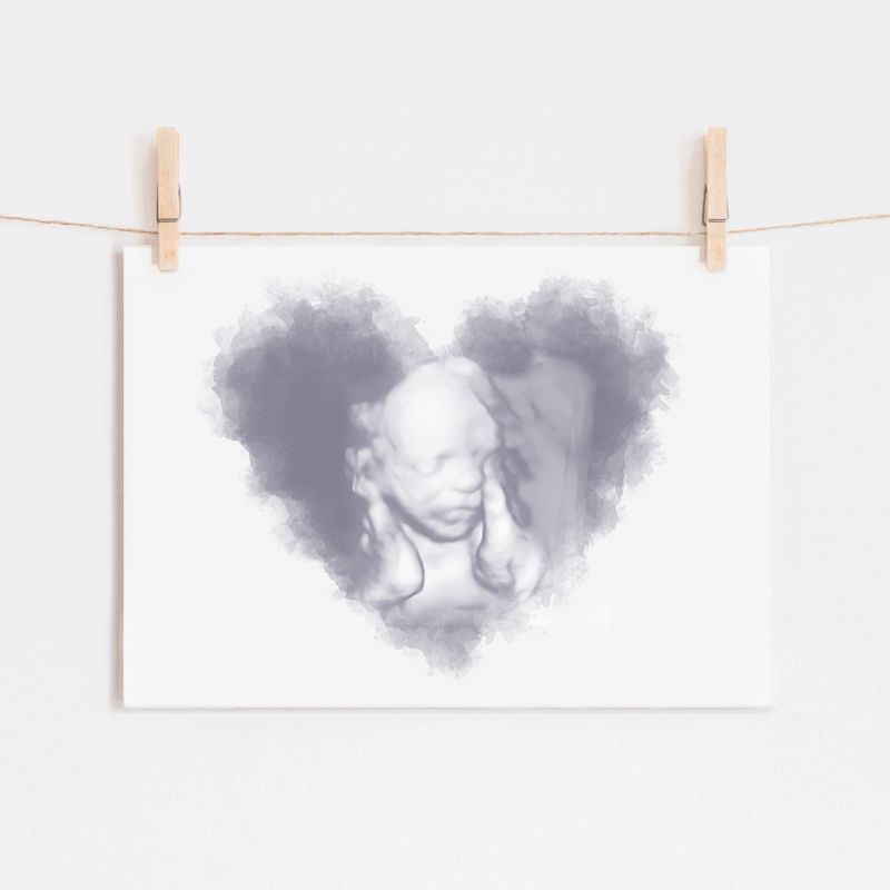 Watercolor Ultrasound Art - Heart