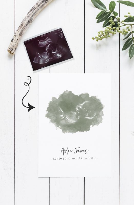 Watercolor Ultrasound Art Print - Portrait