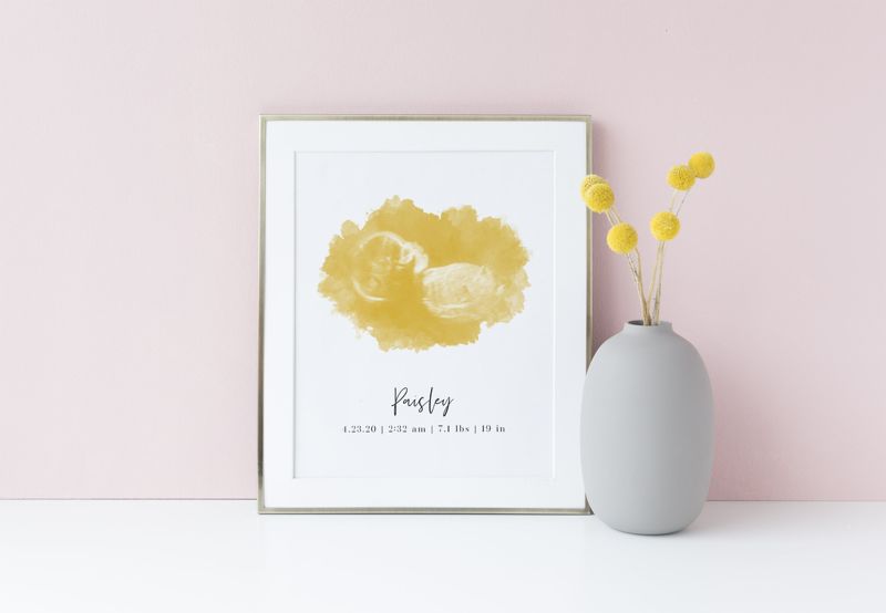 Watercolor Ultrasound Art Print - Portrait