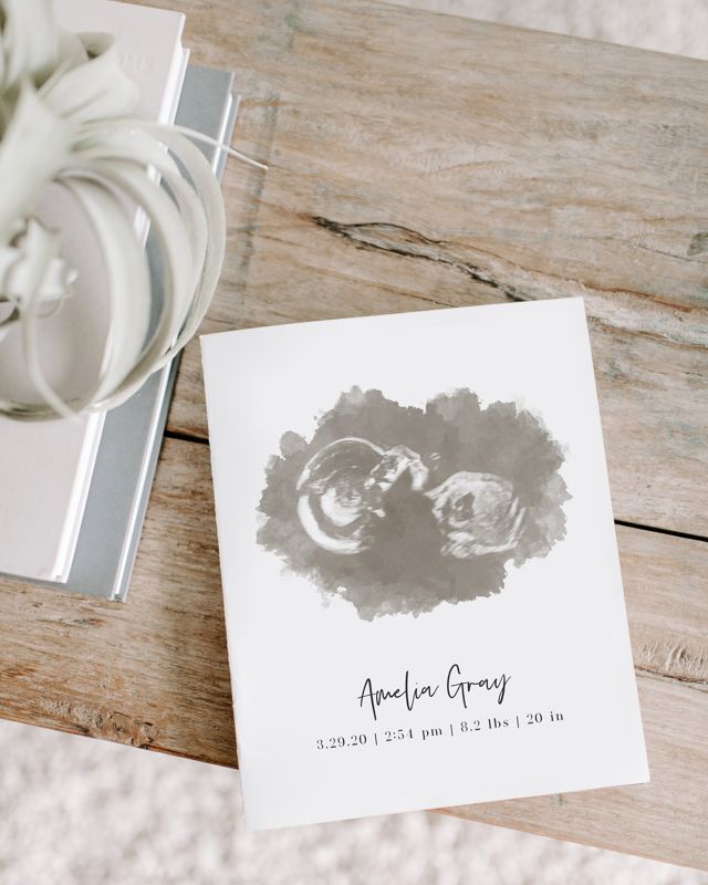 Watercolor Ultrasound Art Print - Portrait