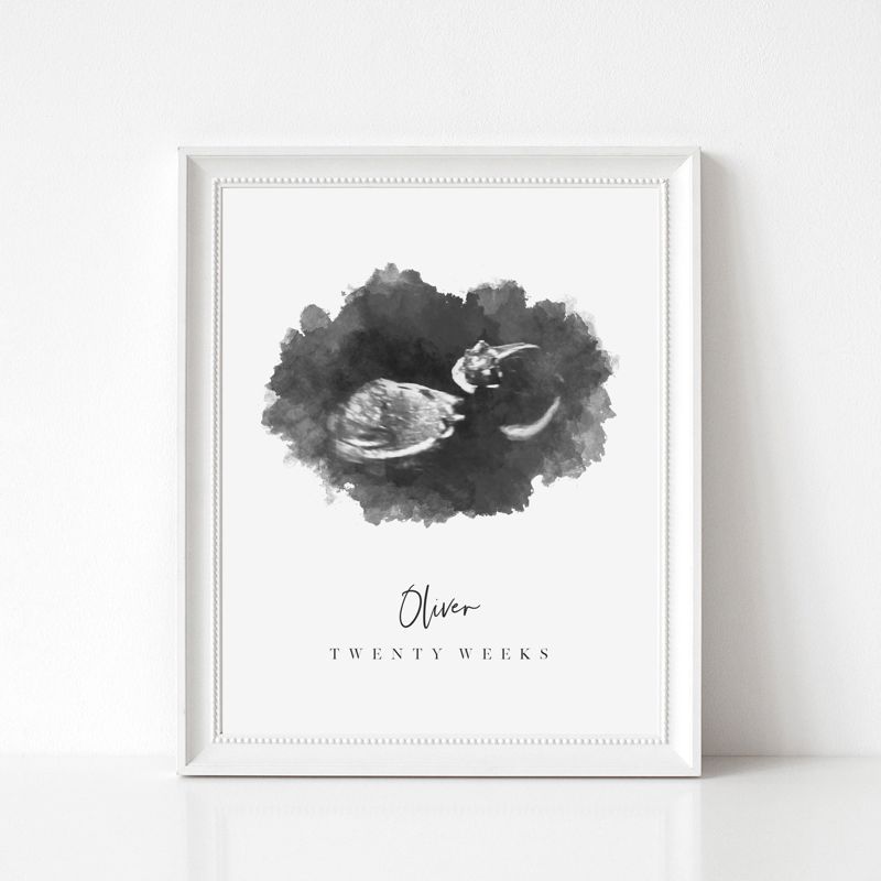 Watercolor Ultrasound Art Print - Portrait