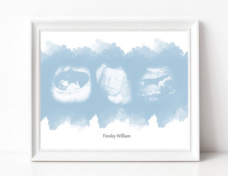 Watercolor Ultrasound Art with Three Images