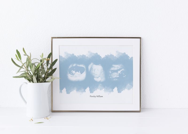 Watercolor Ultrasound Art with Three Images