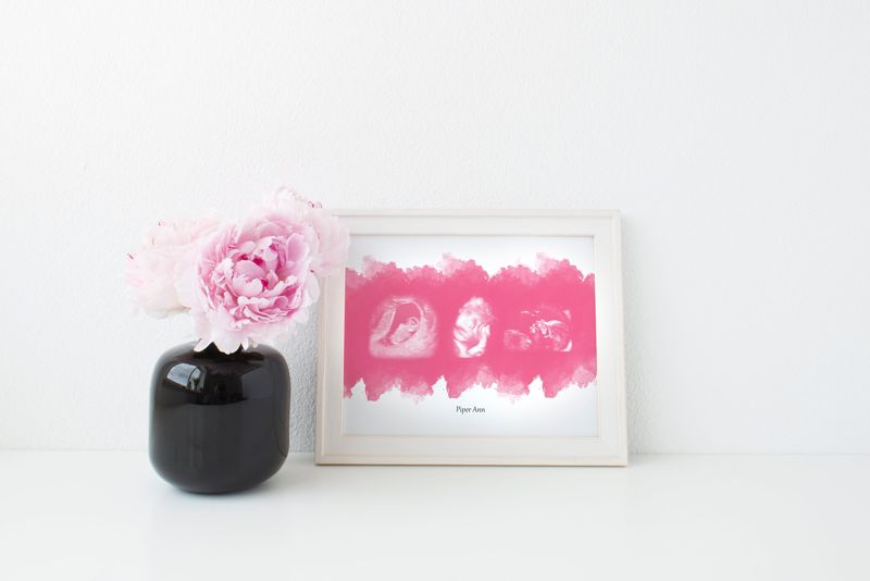 Watercolor Ultrasound Art with Three Images