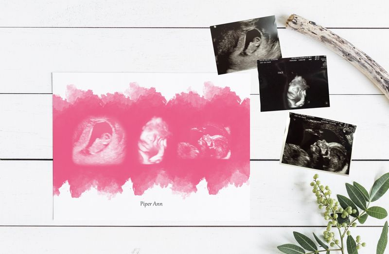Watercolor Ultrasound Art with Three Images