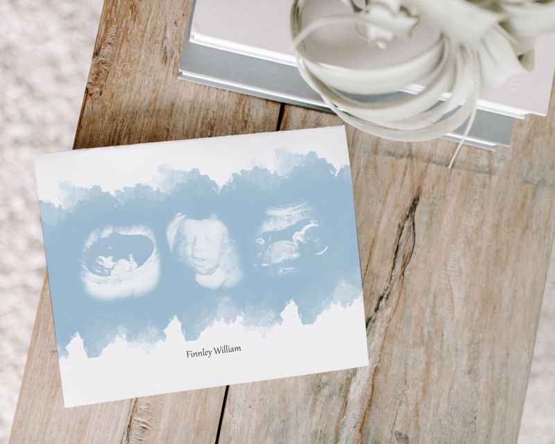 Watercolor Ultrasound Art with Three Images
