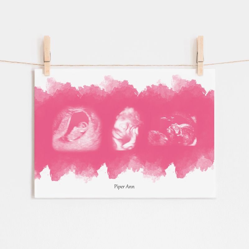 Watercolor Ultrasound Art with Three Images