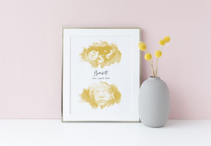 Watercolor Ultrasound Art with Two Images