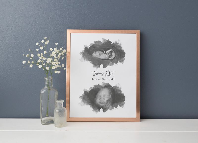 Watercolor Ultrasound Art with Two Images