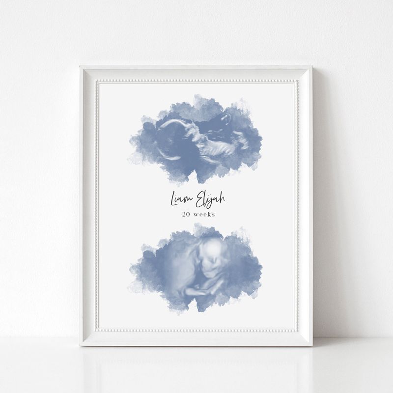 Watercolor Ultrasound Art with Two Images