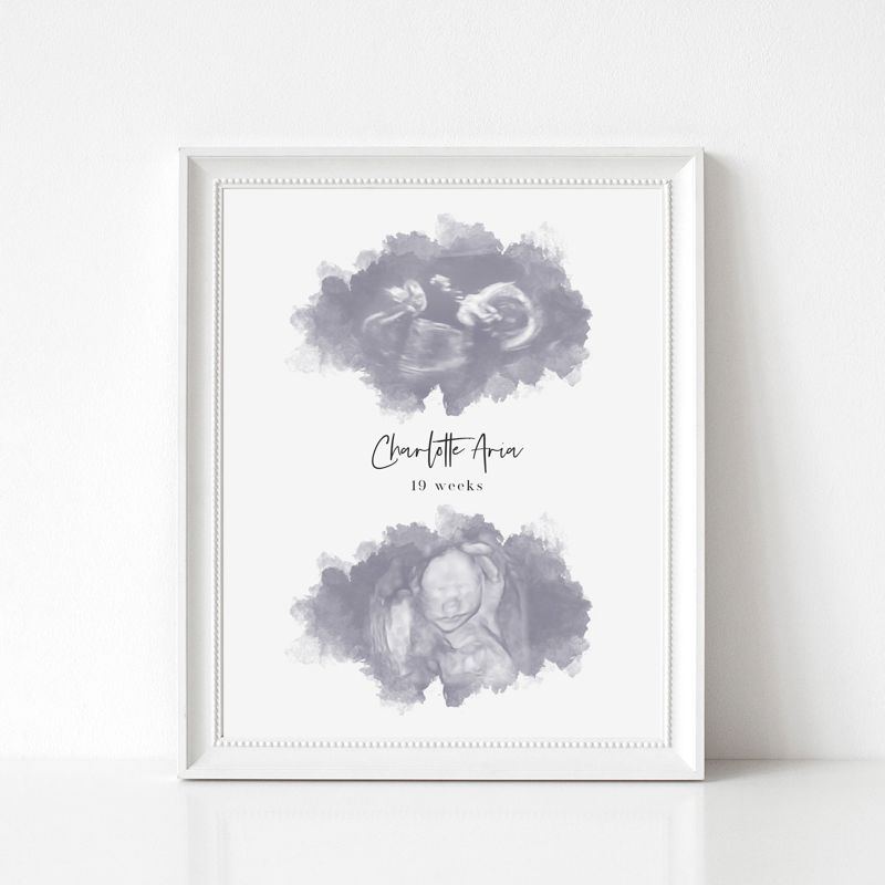 Watercolor Ultrasound Art with Two Images
