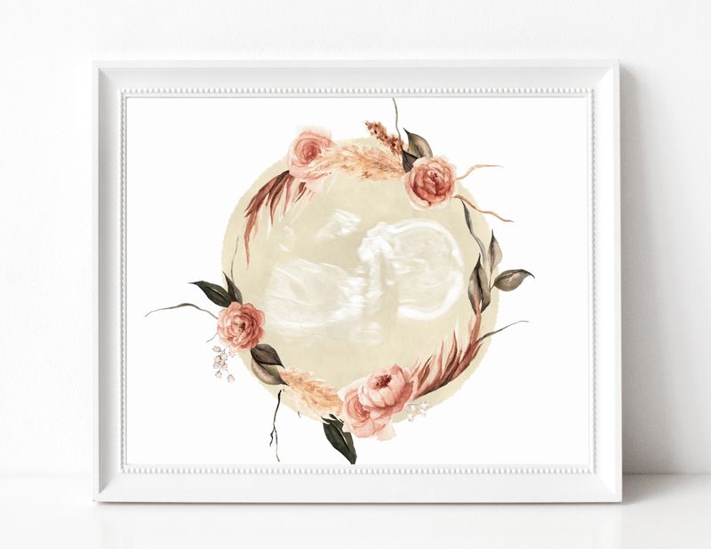Watercolor Ultrasound Art with Floral Wreath