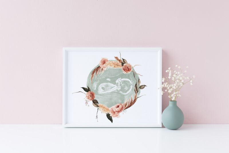 Watercolor Ultrasound Art with Floral Wreath