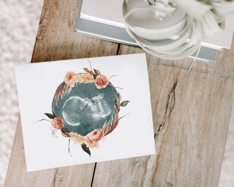 Watercolor Ultrasound Art with Floral Wreath