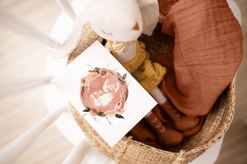 Watercolor Ultrasound Art with Floral Wreath