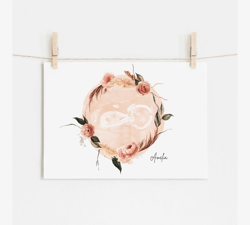 Watercolor Ultrasound Art with Floral Wreath